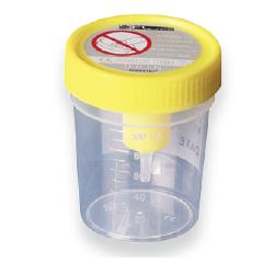 CONTENITORE URINA STERILE MEDIPRESTERIL CON SISTEMA TRANSFERT PER PROVETTE SOTTOVUOTO - famajoy.it